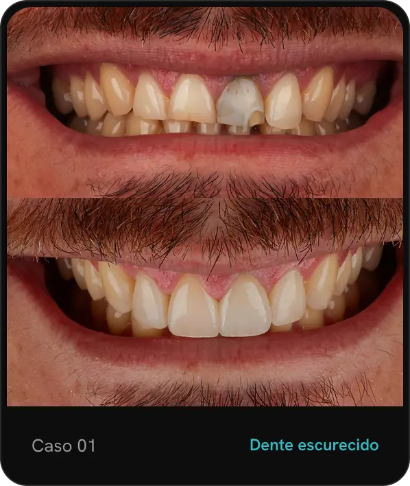 caso01