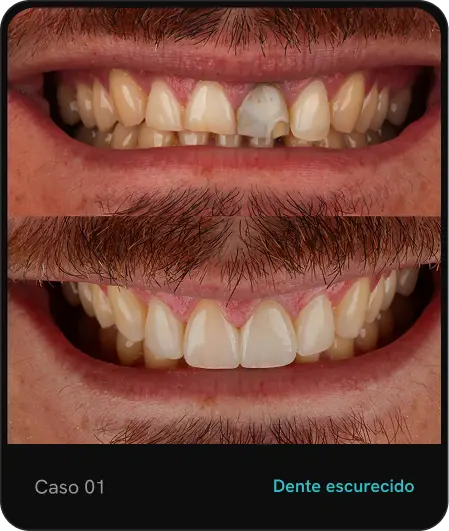 caso01.webp