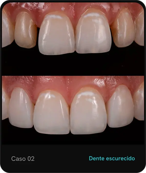 caso02