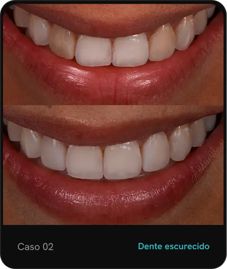 caso02.webp
