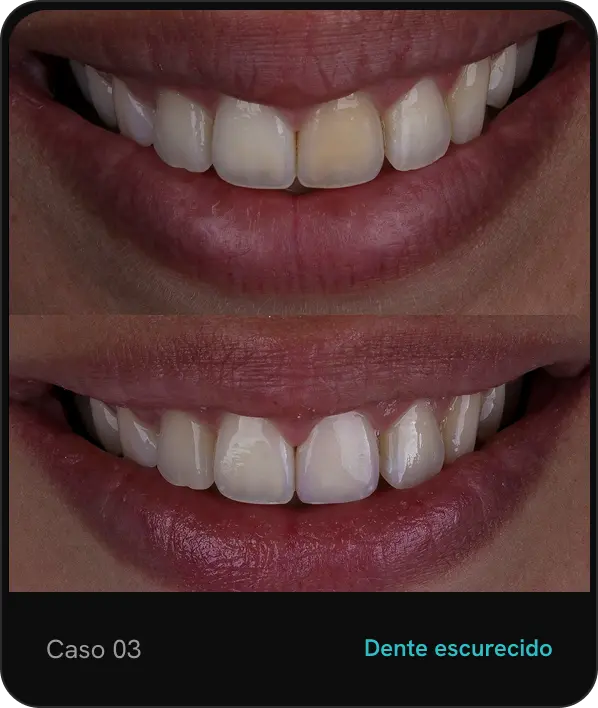 caso03
