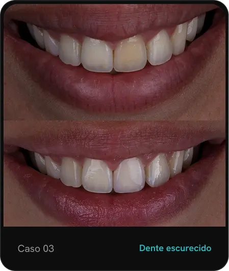 caso03.webp