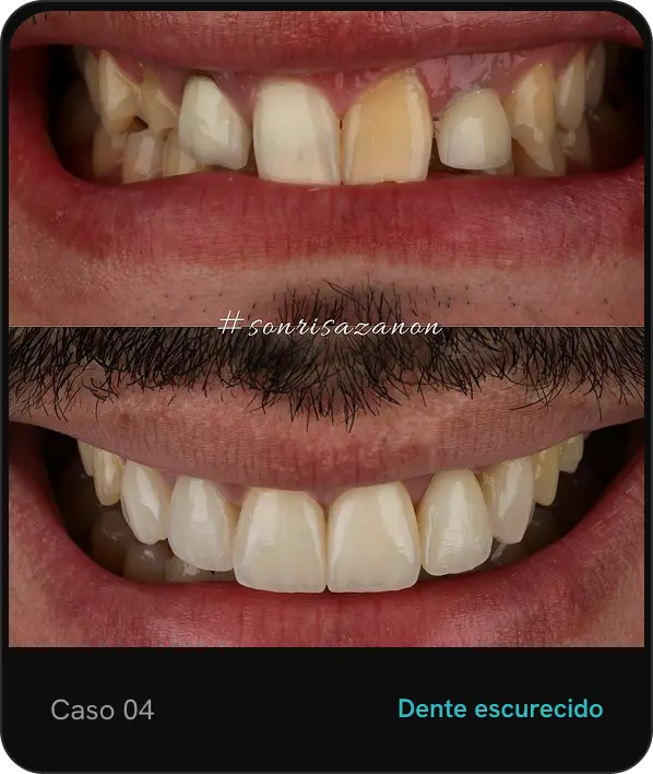 caso04 (1)