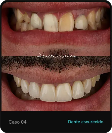 caso04.webp