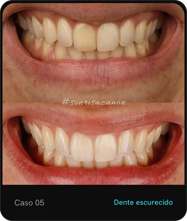 caso05