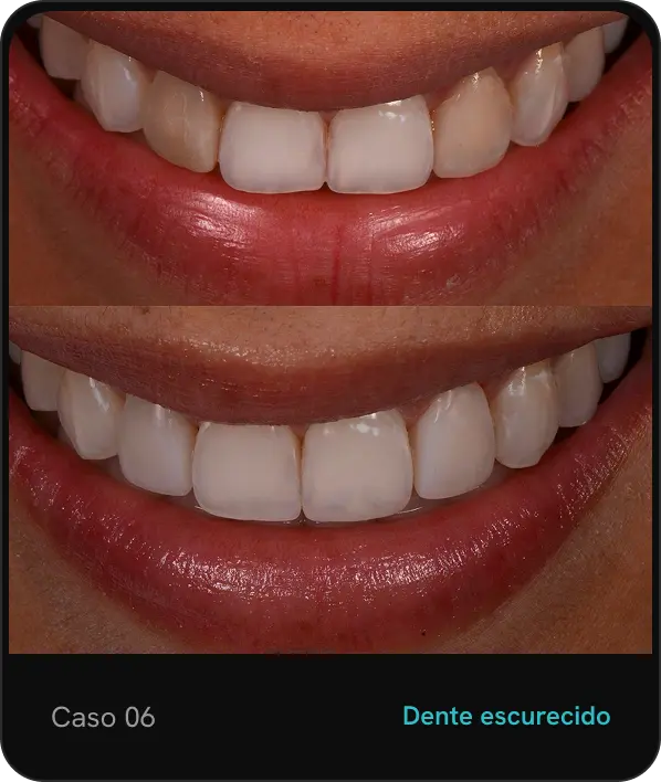 caso06