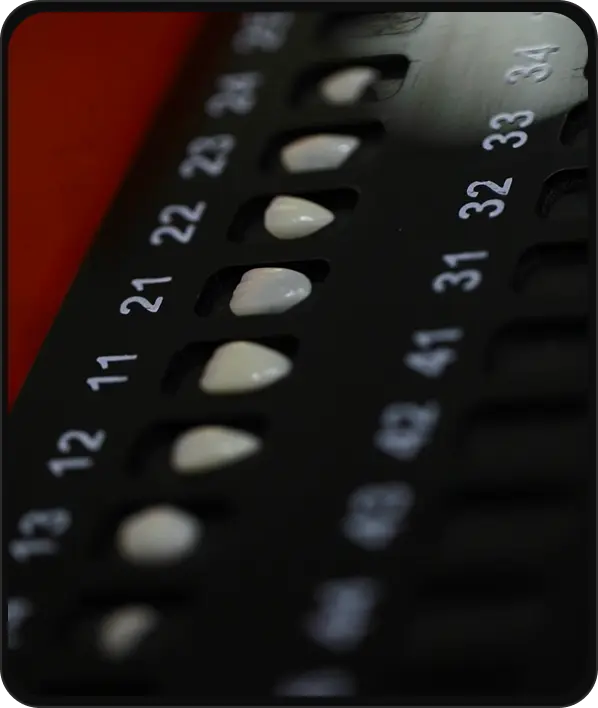 foto7.webp